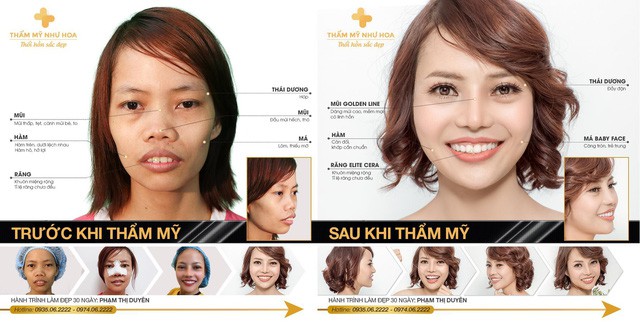 Thẩm mỹ viện Như Hoa mang đến nhiều ưu đãi “khủng” chỉ có trong tháng 7 - Ảnh 4. Thẩm mỹ viện Như Hoa mang đến nhiều ưu đãi “khủng” chỉ có trong tháng 7 - Ảnh 4.