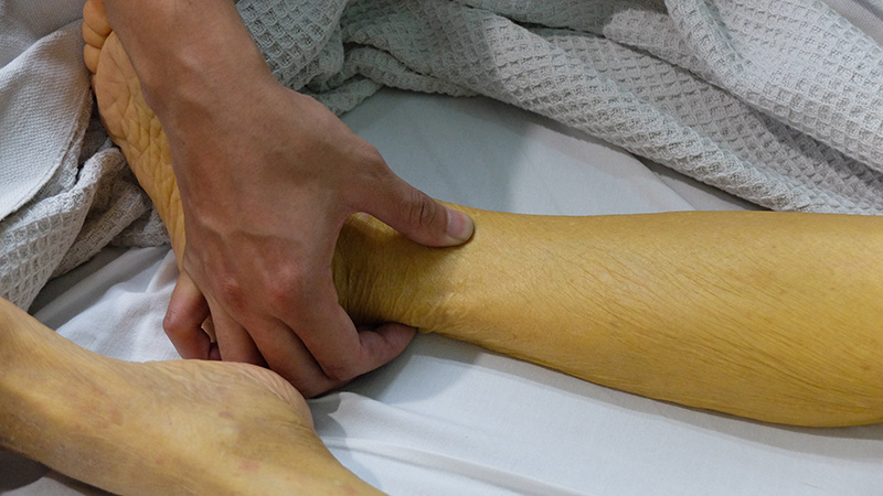 Ung thư tuyến tụy nguy hiểm cỡ nào cũng hiện rõ 9 dấu hiệu này trên da, chị em cần nắm ngay kẻo hối không kịp - Ảnh 2. Ung thư tuyến tụy nguy hiểm cỡ nào cũng hiện rõ 9 dấu hiệu này trên da, chị em cần nắm ngay kẻo hối không kịp - Ảnh 2.