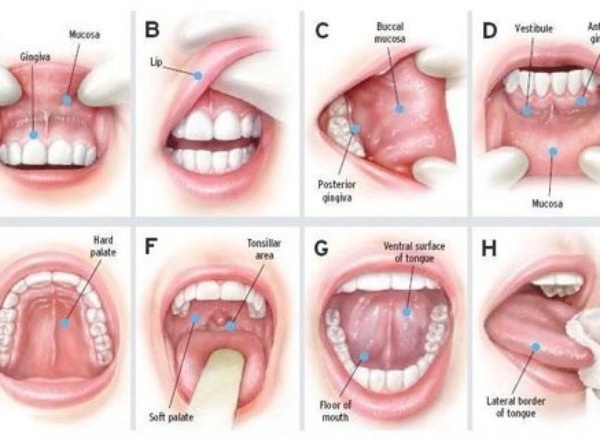 phòng ngừa ung thư phòng ngừa ung thư