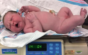 Thêm một em bé vừa lọt lòng đã nặng 6.3kg, không mặc vừa quần áo bố mẹ đã chuẩn bị