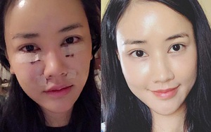 Chưa đầy 1 tháng mà khuôn mặt sau khi thẩm mỹ của Maya khiến nhiều người không nhận ra