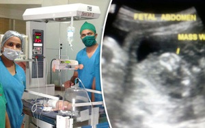 Bé trai vừa lọt lòng mẹ, bác sĩ lập tức mang đi kiểm tra và sốc khi phát hiện thứ này trong dạ dày