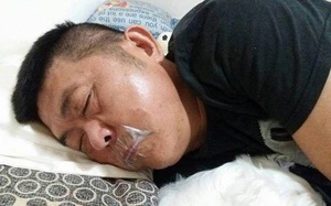 Vợ sốc nặng khi thấy miệng chồng dán băng keo nhưng sự thật phía sau đã khiến cô phải bật khóc