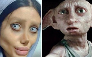 Cô gái phẫu thuật thẩm mỹ hơn 50 lần để nhìn giống Angelina Jolie, kết quả trả về gia tinh Dobby Cô gái phẫu thuật thẩm mỹ hơn 50 lần để nhìn giống Angelina Jolie, kết quả trả về gia tinh Dobby