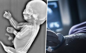 Dù thai đã được 6 tháng, bà mẹ vẫn quyết định bỏ con khi xem hình siêu âm gây sốc này Dù thai đã được 6 tháng, bà mẹ vẫn quyết định bỏ con khi xem hình siêu âm gây sốc này