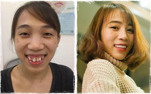 Đức Phúc phiên bản nữ: Từng xấu xí đến mức bị sỉ nhục là “khỉ đột đội lốt người” và hành trình phẫu thuật toàn bộ gương mặt để theo đuổi đam mê ca hát