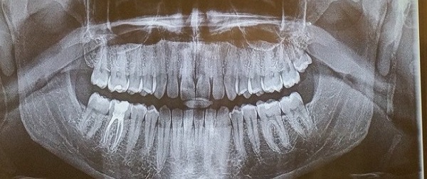 Chỉ một số ít người trên thế giới sở hữu đặc điểm lạ lùng này