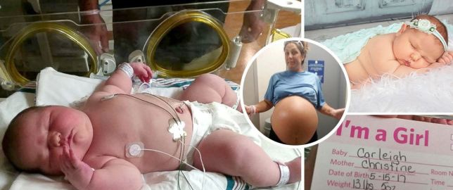 Mẹ bầu bụng to bất thường, bác sĩ đinh ninh là sinh đôi nhưng không ngờ