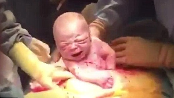 Bà mẹ vừa đẻ vừa cầm điện thoại quay lại toàn bộ quá trình sinh mổ của mình