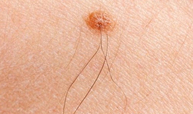 Ph&aacute;t hiện những điểm lạ l&ugrave;ng n&agrave;y tr&ecirc;n cơ thể l&agrave; b&aacute;o hiệu may mắn đang đến gần, sẽ ph&aacute;t t&agrave;i trong thời gian ngắn - Ảnh 3.