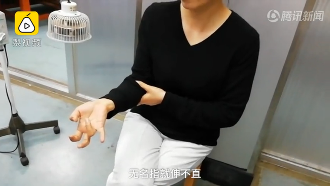 Giật m&igrave;nh với h&igrave;nh ảnh b&agrave;n tay bị liệt v&agrave; cột sống cong: B&agrave;i học cho những ai hay d&ugrave;ng điện thoại theo c&aacute;ch n&agrave;y - Ảnh 1.