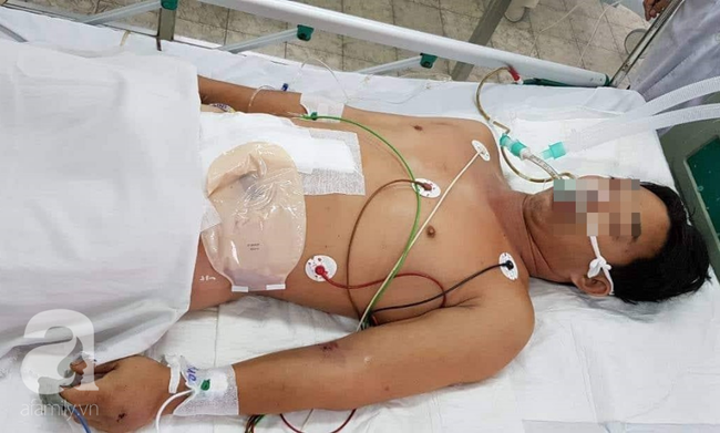 Người đ&agrave;n &ocirc;ng ở Đồng Nai bị cắt ngang bụng, thủng ruột kinh ho&agrave;ng do m&aacute;y cưa vướng v&agrave;o &aacute;o - Ảnh 2.