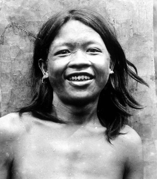 Đ&acirc;y l&agrave; những phương ph&aacute;p l&agrave;m đẹp v&ocirc; c&ugrave;ng kinh dị, mới nghe đ&atilde; thấy dựng t&oacute;c g&aacute;y nhưng lại được người trong qu&aacute; khứ ưa chuộng - Ảnh 6.