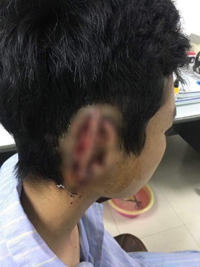 Nam sinh cắn đứt rồi nuốt tai của bạn v&agrave;o bụng &acirc;m t&iacute;nh với ma t&uacute;y? - Ảnh 1.