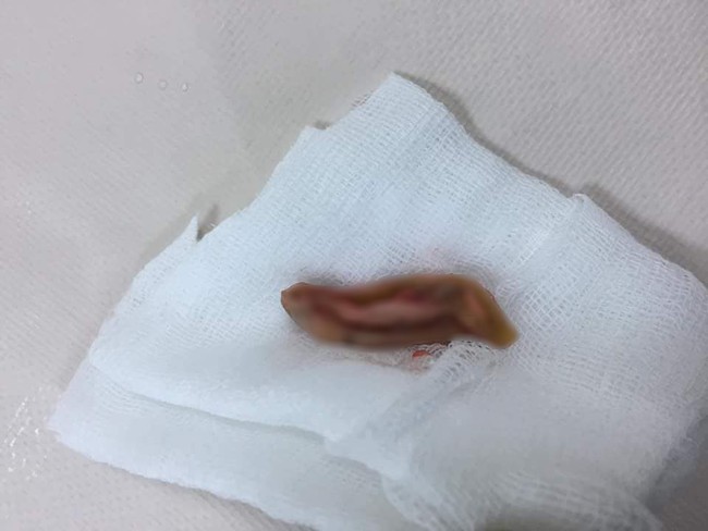 Nam sinh cắn đứt rồi nuốt tai của bạn v&agrave;o bụng &acirc;m t&iacute;nh với ma t&uacute;y? - Ảnh 2.