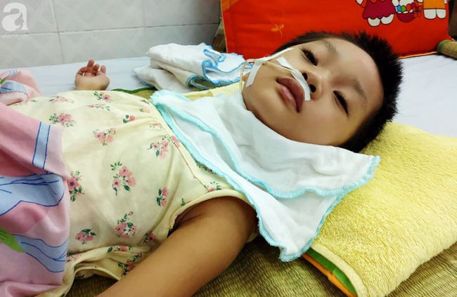 Sau cơn co giật bé gái 5 tuổi phát hiện viêm màng não, hơn 1 tháng không ngủ và liên tục la hét  - Ảnh 2.