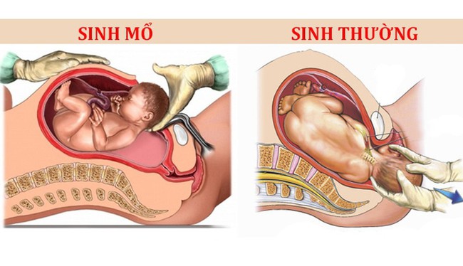 Hồi hộp xem đầy đủ trình tự các bước trong 1 ca sinh mổ trong clip thu hút 71 triệu lượt xem - Ảnh 9.