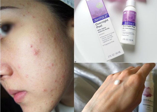 Có nhất thiết phải dưỡng đủ 10 bước chăm sóc da của Hàn, câu trả lời sẽ có ngay trong bài viết này! - Ảnh 5. Có nhất thiết phải dưỡng đủ 10 bước chăm sóc da của Hàn, câu trả lời sẽ có ngay trong bài viết này! - Ảnh 5.