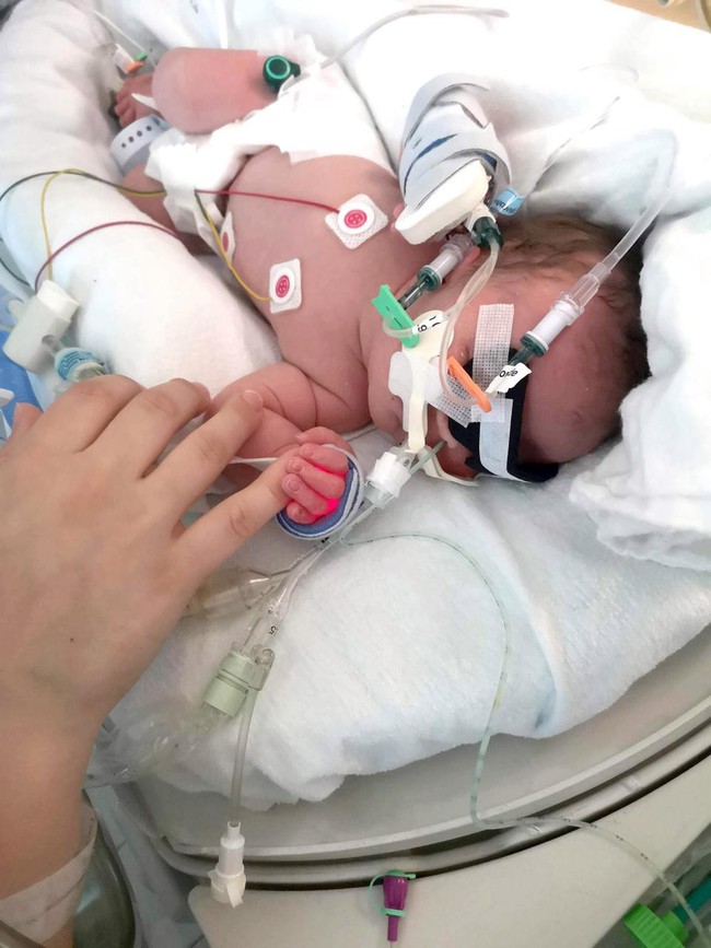 Bé sinh được 5 ngày nhưng mắt vẫn nhắm nghiền, bố mẹ tá hỏa khi biết con mắc chứng rối loạn di truyền hiếm gặp gây mù mắt - Ảnh 2.