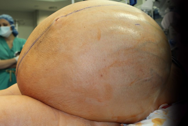 7 ca b&ecirc;̣nh g&acirc;y chấn động nhất năm 2018 nghe chừng tưởng như chỉ c&oacute; trong phim kinh dị  - Ảnh 4.