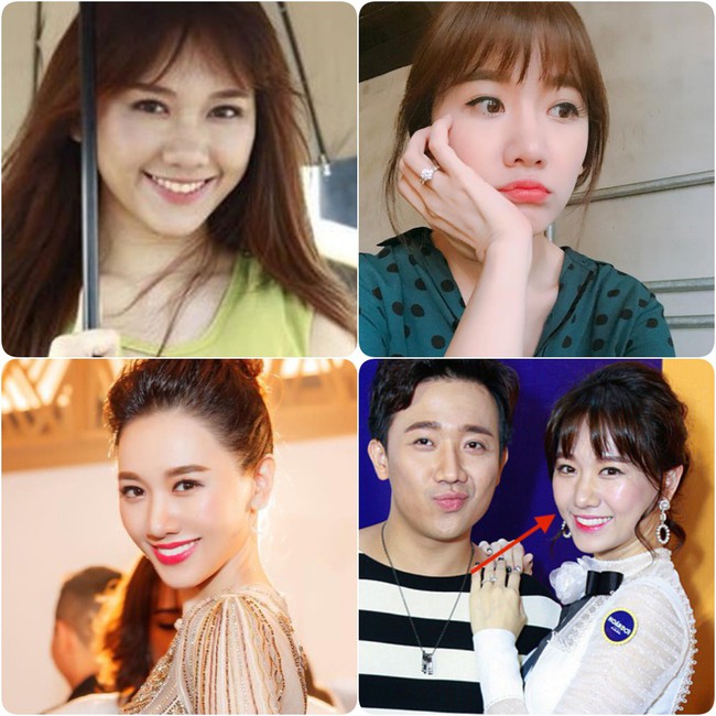 Vừa mới vướng nghi &aacute;n chỉnh sửa &iacute;t l&acirc;u, chiếc mũi của Hari Won bỗng gồ ghề bất thường thế n&agrave;y  - Ảnh 6.