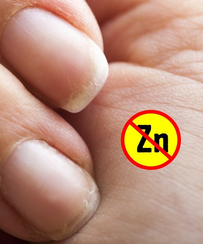 7 biểu hiện ở đôi tay tiết lộ các bệnh mà cơ thể đang mắc, dấu hiệu đầu tiên cảnh báo bạn đang bị bệnh gan đấy - Ảnh 6.