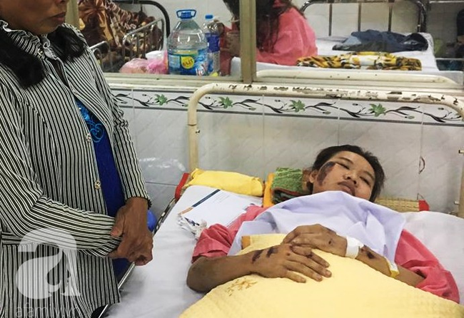 Nữ sinh l&acirc;m nạn vụ container t&ocirc;ng h&agrave;ng chục người thương vong: Xe m&aacute;y g&atilde;y l&agrave;m đ&ocirc;i, &aacute;o mưa r&aacute;ch từ trắng th&agrave;nh m&agrave;u đỏ - Ảnh 4.