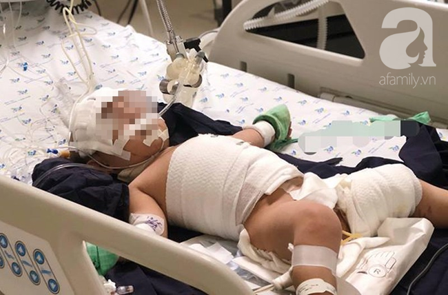 Tai nạn kinh hoàng cận Tết: Cầm bút chì chơi rồi vấp ngã, bé gái 6 tuổi bị đâm xuyên từ mũi đến hốc mắt - Ảnh 8.
