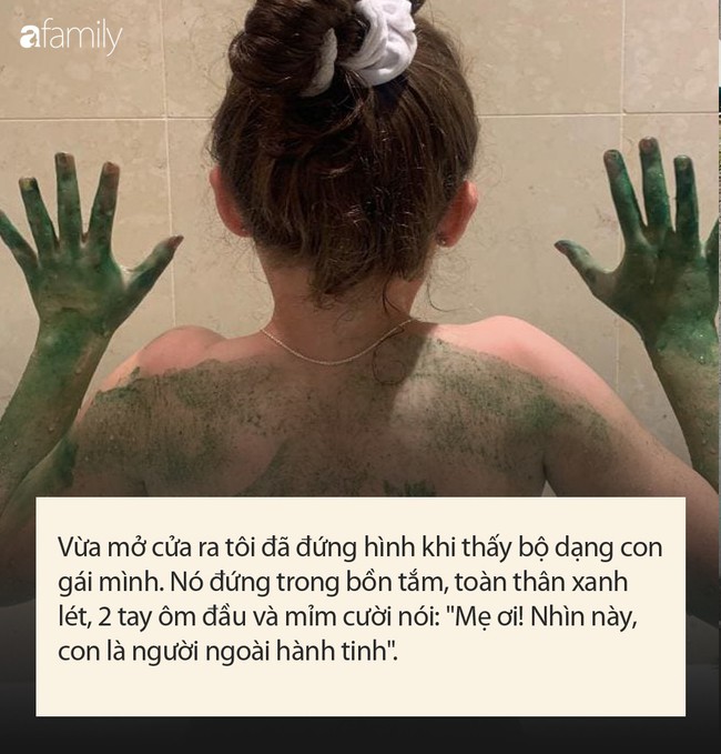 Nghe tiếng con hét trong nhà tắm, mẹ chạy vào và sửng sốt khi thấy con trông như "người ngoài hành tinh" - Ảnh 2. Nghe tiếng con hét trong nhà tắm, mẹ chạy vào và sửng sốt khi thấy con trông như "người ngoài hành tinh" - Ảnh 2.