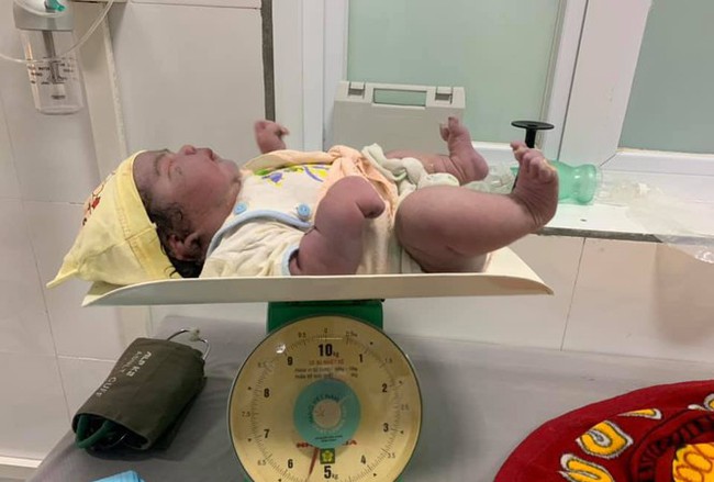 Kỳ tích sản phụ sinh thường bé gái nặng 5,5kg tại huyện miền núi Nghệ An - Ảnh 1. Kỳ tích sản phụ sinh thường bé gái nặng 5,5kg tại huyện miền núi Nghệ An - Ảnh 1.