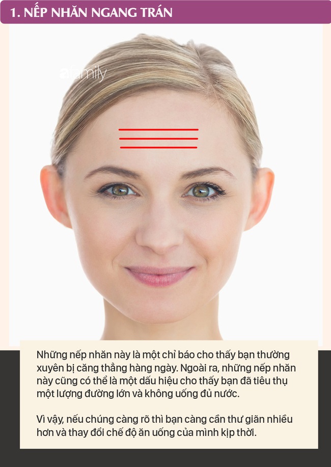 Mỗi nếp nhăn trên khuôn mặt gửi một thông điệp về sức khỏe, dưới đây là 10 vị trí nếp nhăn bạn cần nhận ra - Ảnh 1.