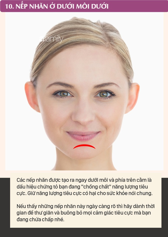 Mỗi nếp nhăn trên khuôn mặt gửi một thông điệp về sức khỏe, dưới đây là 10 vị trí nếp nhăn bạn cần nhận ra - Ảnh 10.
