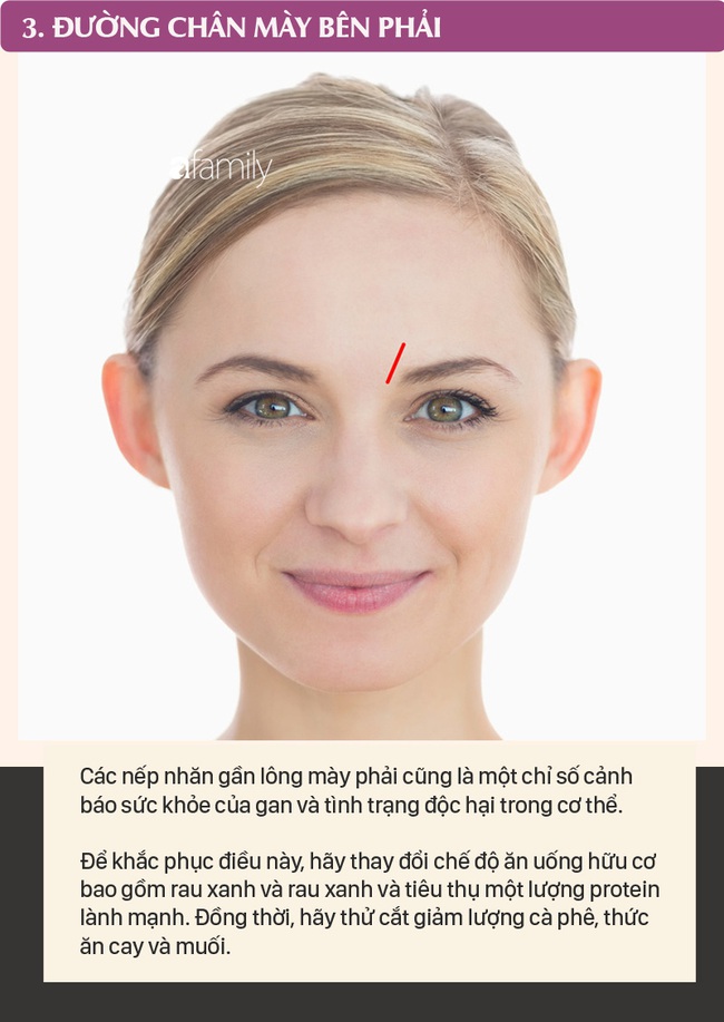Mỗi nếp nhăn trên khuôn mặt gửi một thông điệp về sức khỏe, dưới đây là 10 vị trí nếp nhăn bạn cần nhận ra - Ảnh 3.
