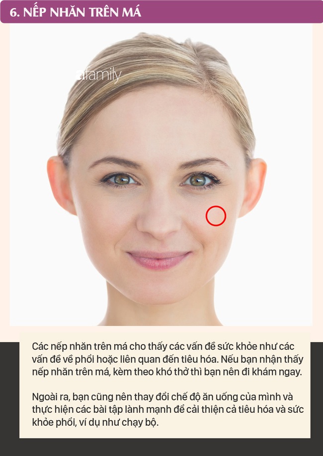 Mỗi nếp nhăn trên khuôn mặt gửi một thông điệp về sức khỏe, dưới đây là 10 vị trí nếp nhăn bạn cần nhận ra - Ảnh 6.