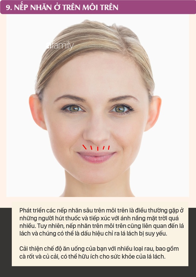 Mỗi nếp nhăn trên khuôn mặt gửi một thông điệp về sức khỏe, dưới đây là 10 vị trí nếp nhăn bạn cần nhận ra - Ảnh 9.