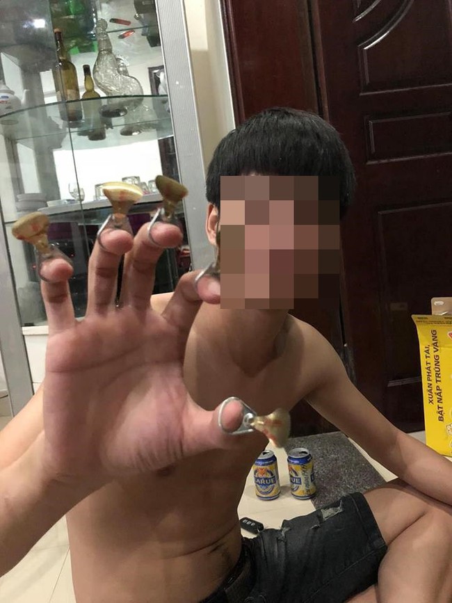 Ca lụy t&igrave;nh khiến MXH s&ocirc;i m&aacute;u: C&ocirc; g&aacute;i vẫn tha thứ mặc bạn trai nhiều lần bạo h&agrave;nh, tay ch&acirc;n bầm dập, v&agrave;o viện như cơm bữa - Ảnh 1.