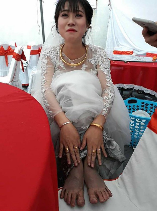 Về nh&agrave; chồng đ&uacute;ng ng&agrave;y mưa gi&oacute;, đ&ocirc;i ch&acirc;n c&ocirc; d&acirc;u tố c&aacute;o mọi nỗi khổ - Ảnh 2.