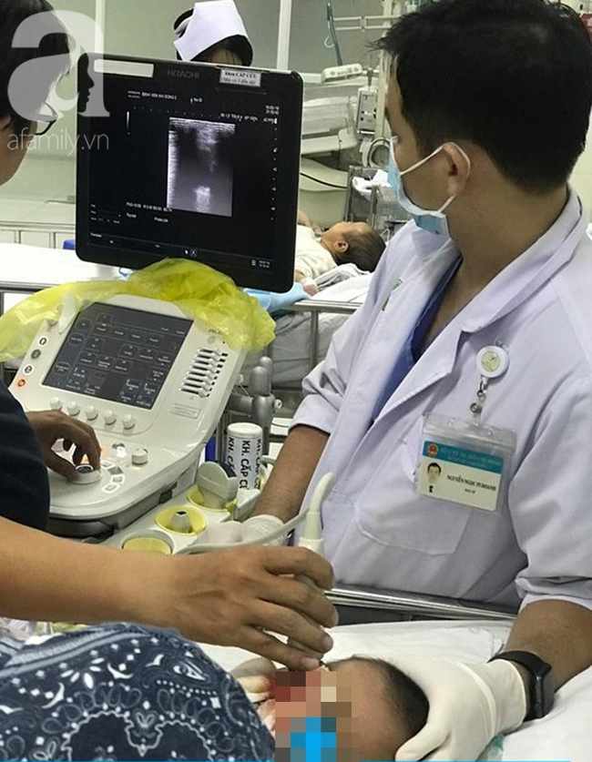 Mẹ hốt hoảng khi thấy con trai 5 tuổi cầm thanh sắt chạy đi chơi thì bị đâm xuyên hốc mắt lên đến não - Ảnh 3. Mẹ hốt hoảng khi thấy con trai 5 tuổi cầm thanh sắt chạy đi chơi thì bị đâm xuyên hốc mắt lên đến não - Ảnh 3.