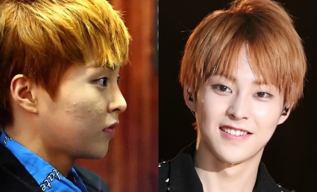 Loạt h&igrave;nh g&oacute;c nghi&ecirc;ng g&acirc;y b&atilde;o của d&agrave;n sao ch&acirc;u &Aacute;: Người đẹp như ti&ecirc;n nữ, kẻ lộ dấu vết dao k&eacute;o - Ảnh 10.