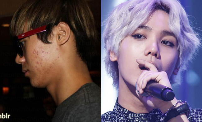 Loạt h&igrave;nh g&oacute;c nghi&ecirc;ng g&acirc;y b&atilde;o của d&agrave;n sao ch&acirc;u &Aacute;: Người đẹp như ti&ecirc;n nữ, kẻ lộ dấu vết dao k&eacute;o - Ảnh 11.