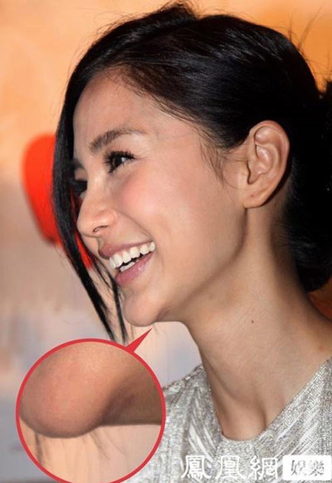 Loạt h&igrave;nh g&oacute;c nghi&ecirc;ng g&acirc;y b&atilde;o của d&agrave;n sao ch&acirc;u &Aacute;: Người đẹp như ti&ecirc;n nữ, kẻ lộ dấu vết dao k&eacute;o - Ảnh 16.