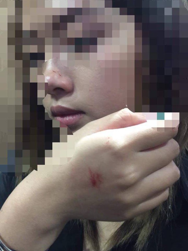 Tình tiết bất ngờ vụ dê xồm cưỡng hôn nữ sinh viên trong thang máy chung cư ở Hà Nội - Ảnh 1.