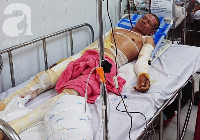 Chiết xăng xe để đi làm nuôi vợ con, người đàn ông bị bốc cháy, hóa thành ngọn đuốc sống - Ảnh 1. Chiết xăng xe để đi làm nuôi vợ con, người đàn ông bị bốc cháy, hóa thành ngọn đuốc sống - Ảnh 1.