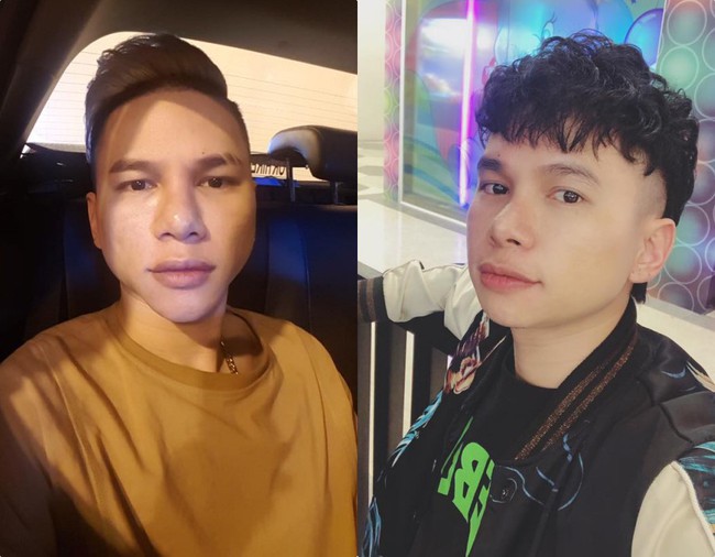 Khi sao nam Vbiz đổ x&ocirc; đi thẩm mỹ: Người lột x&aacute;c nam thần đến kh&oacute; tin, người lại l&agrave; sản phẩm dao k&eacute;o qu&aacute; đ&agrave; khiến nhan sắc tuột dốc - Ảnh 10.