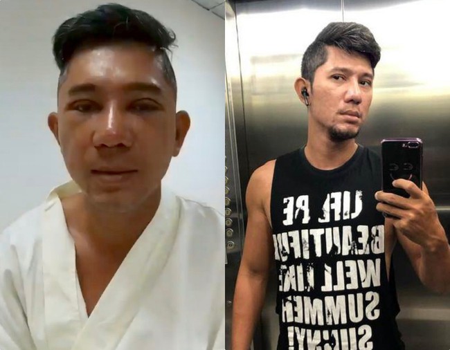 Khi sao nam Vbiz đổ x&ocirc; đi thẩm mỹ: Người lột x&aacute;c nam thần đến kh&oacute; tin, người lại l&agrave; sản phẩm dao k&eacute;o qu&aacute; đ&agrave; khiến nhan sắc tuột dốc - Ảnh 4.