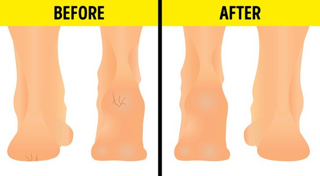 6 c&aacute;ch quấn người gi&uacute;p cơ thể thon gọn như tượng tạc - Ảnh 4.