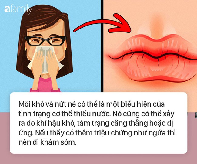 8 dấu hiệu ở môi cứ xuất hiện là cảnh báo bệnh, bạn cần đi khám sớm là tốt nhất  - Ảnh 2.