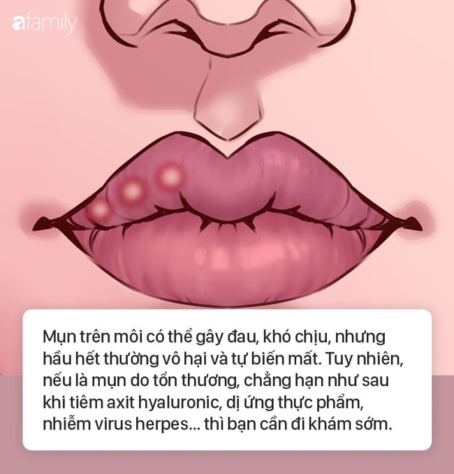 8 dấu hiệu ở môi cứ xuất hiện là cảnh báo bệnh, bạn cần đi khám sớm là tốt nhất  - Ảnh 3.