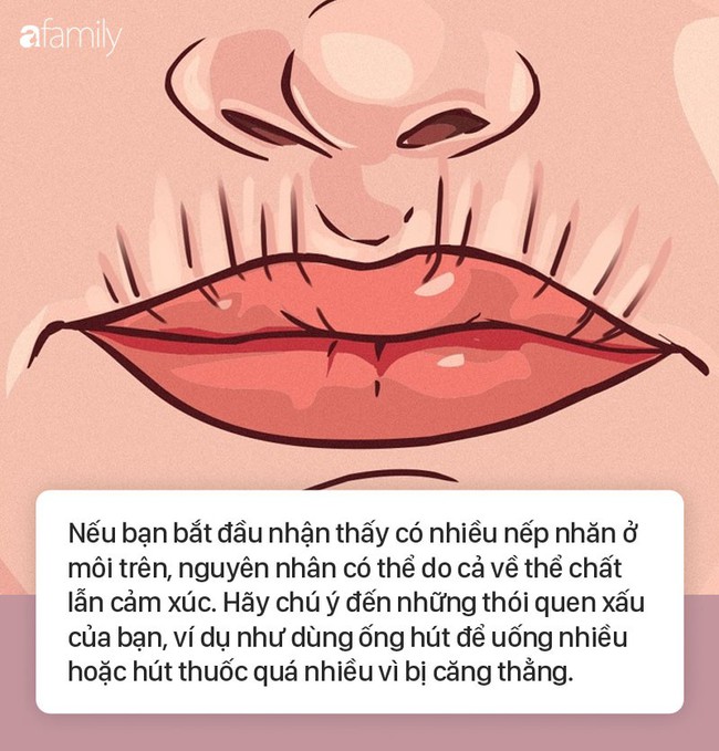 8 dấu hiệu ở môi cứ xuất hiện là cảnh báo bệnh, bạn cần đi khám sớm là tốt nhất  - Ảnh 5.