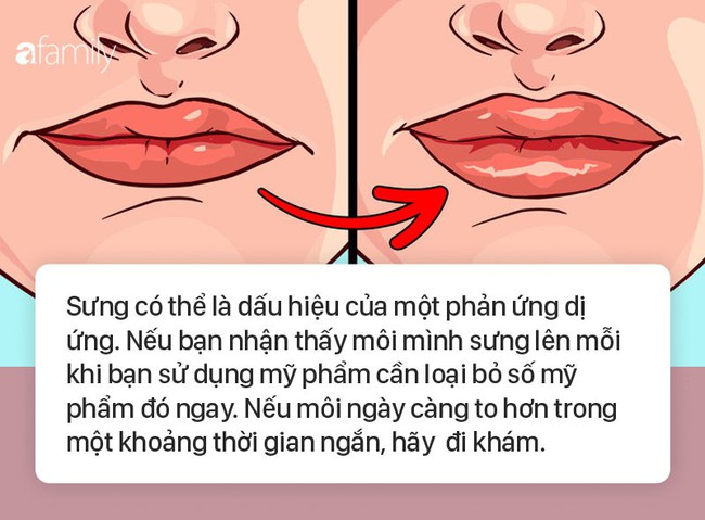 8 dấu hiệu ở môi cứ xuất hiện là cảnh báo bệnh, bạn cần đi khám sớm là tốt nhất  - Ảnh 7.